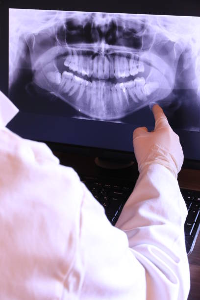 Best Emergency Denture Repair in Cedartown, GA